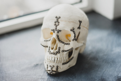 Mund-, Kiefer-, Gesichtschirurgie – Coburg – Feller / Otte – Details der Praxis Mund-, Kiefer-, Gesichtschirurgie - Coburg - Feller / Otte - Details der Praxis